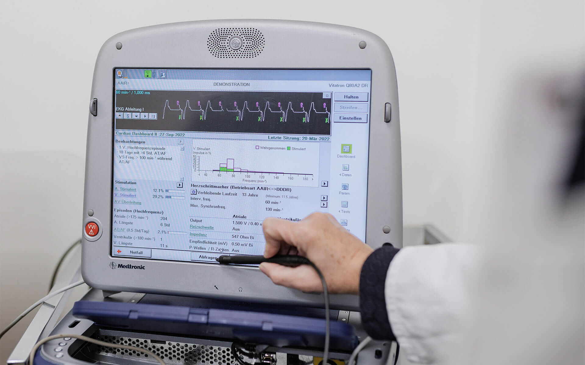 EKG Diagnostik in der Klinik Eichholz